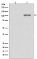 Phospho-IRE1 (S724) Antibody
